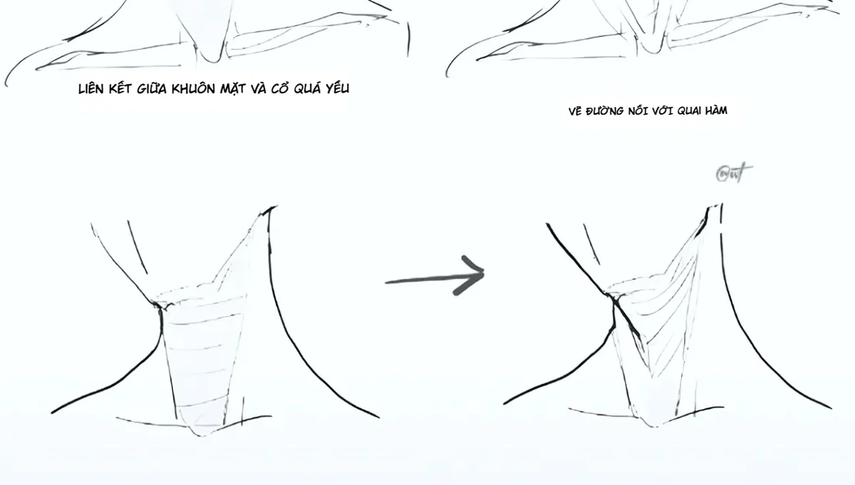 So sánh vùng dưới cằm và cổ trước sau khi sửa đường nối, nếp cổ và chiều sâu.